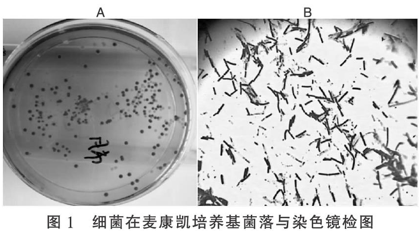 一株肉鸡源大肠杆菌的分离鉴定与致病性分析