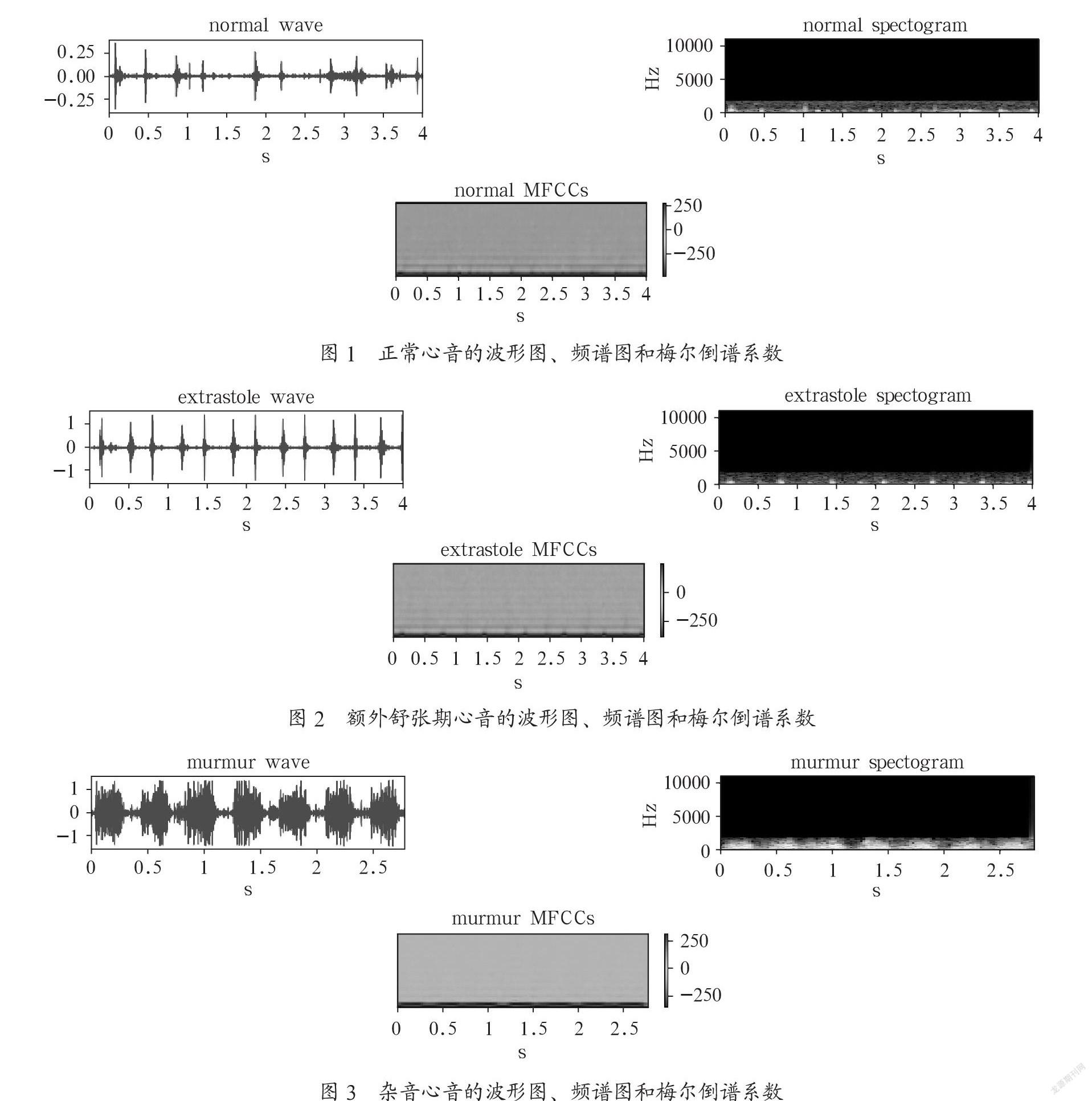 基于CNN-LSTM心音分类方法的研究