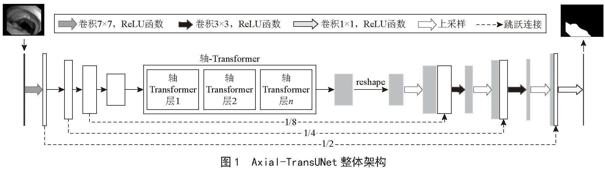 基于轴-Transformer的医学图像分割模型Axial-TransUNet